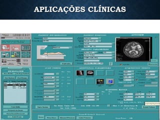 APLICAÇÕES CLÍNICAS
 