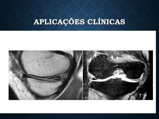 APLICAÇÕES CLÍNICAS
 