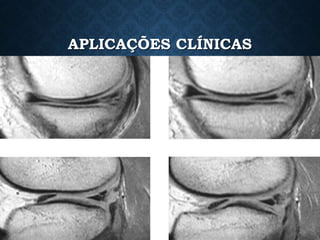 APLICAÇÕES CLÍNICAS
 