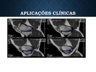 APLICAÇÕES CLÍNICAS
 