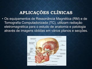 APLICAÇÕES CLÍNICAS
• Os equipamentos de Ressonância Magnética (RM) e de
Tomografia Computadorizada (TC), utilizam radiação
eletromagnética para o estudo de anatomia e patologia
através de imagens obtidas em vários planos e secções.
 