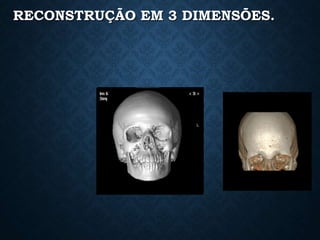 RECONSTRUÇÃO EM 3 DIMENSÕES.
 