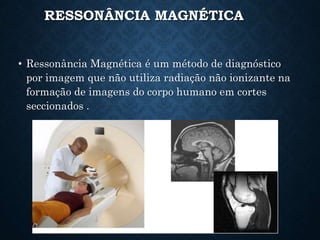 RESSONÂNCIA MAGNÉTICA
• Ressonância Magnética é um método de diagnóstico
por imagem que não utiliza radiação não ionizante na
formação de imagens do corpo humano em cortes
seccionados .
 