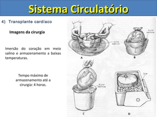 4) Transplante cardíaco
Imagens da cirurgia
Sistema CirculatórioSistema Circulatório
Imersão do coração em meio
salino e armazenamento a baixas
temperaturas.
Tempo máximo de
armazenamento até a
cirurgia: 4 horas.
 