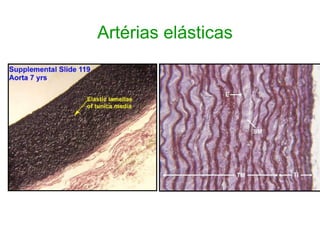 Artérias elásticas
 