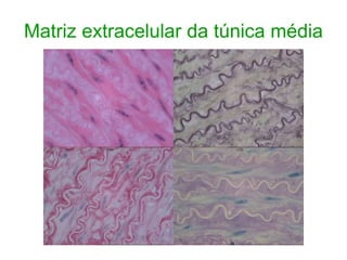 Matriz extracelular da túnica média
 