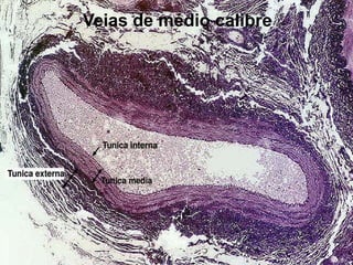 Veias de médio calibre
 