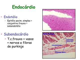 Endocárdio
• Endotélio
• Epitélio pavim. simples +
conjuntivo frouxo =
subendotélio
• Subendocárdio
• T.c.frouxo + vasos
+ nervos e fibras
de purkinje
 