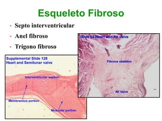 Esqueleto Fibroso
• Septo interventricular
• Anel fibroso
• Trígono fibroso
 