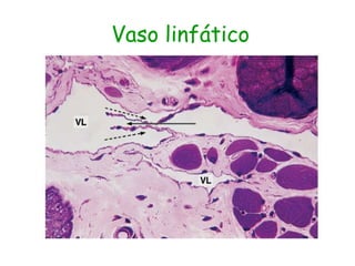 Vaso linfático
 