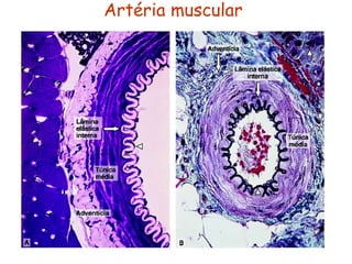 Artéria muscular
 