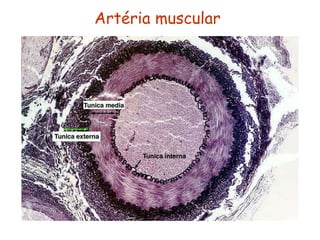 Artéria muscular
 