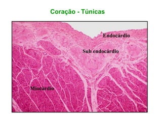Coração - Túnicas
Endocárdio
Sub endocárdio
Miocàrdio
 