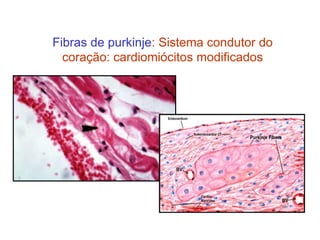 Fibras de purkinje: Sistema condutor do
coração: cardiomiócitos modificados
 