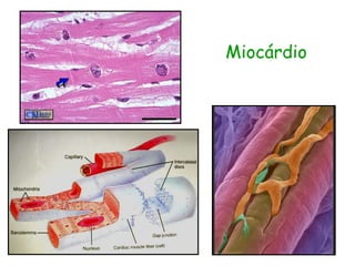 Miocárdio
 