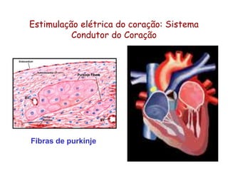 Estimulação elétrica do coração: Sistema
Condutor do Coração
Fibras de purkinje
 