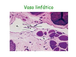 Vaso linfático
 