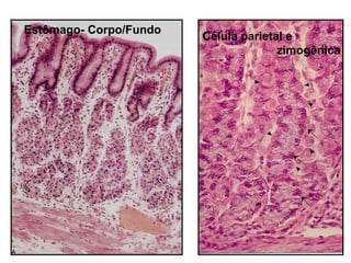 Estômago- Corpo/Fundo
Célula parietal e
zimogênica
 