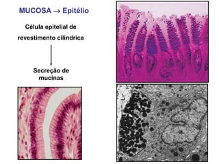 MUCOSA  Epitélio
Célula epitelial de
revestimento cilíndrica
Secreção de
mucinas
 