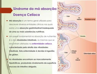Síndrome da má absorção:
Doença Celíaca
 Má absorção é um termo geral utilizado para
descrever diversas entidades clínicas nas quais
existe uma absorção gastrintestinal inadequada
de uma ou mais substâncias nutritivas.
 Um papel fundamental na absorção de nutrientes
é o das vilosidades intestinais, as mesmas que se
encontram afetadas na enfermidade celíaca,
caracterizada pela atrofia das vilosidades
intestinais. Esta enfermidade é devida à ingestão
de glúten.
 As vilosidades encontram-se marcadamente
hipotróficas, produzindo nivelamento da superfície
mucosa do intestino delgado.
 