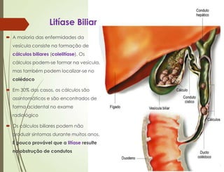 Litíase Biliar
 A maioria das enfermidades da
vesícula consiste na formação de
cálculos biliares (colelitíase). Os
cálculos podem-se formar na vesícula,
mas também podem localizar-se no
colédoco
 Em 30% dos casos, os cálculos são
assintomáticos e são encontrados de
forma acidental no exame
radiológico
 Os cálculos biliares podem não
produzir sintomas durante muitos anos.
É pouco provável que a litíase resulte
na obstrução de condutos
 