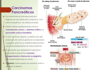Carcinomas
Pancreáticos
 Os carcinomas do pâncreas exócrino
originam-se nas células dos condutos e, com
menor frequência, nas células acinares.
 Existem fatores predisponentes como a
colecistopatia crônica, o diabetes mellitus e a
pancreatite crônica hereditária.
 O vício de fumar cigarros, as dietas com alta
proporção de carne e gorduras e a exposição
a agentes químicos no trabalho diário fecham
a lista de predisposições do meio ambiente.
 Os pacientes que apresentam carcinoma
pancreático apresentam anorexia,
emagrecimento e intensa dor no epigástrio,
que pode irradiar para as costas.
 *Epigástrio. Parte superior do abdome, entre o
umbigo e o esterno.
 