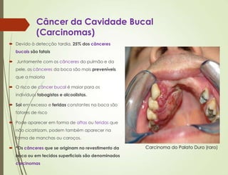 Câncer da Cavidade Bucal
(Carcinomas)
 Devido à detecção tardia, 25% dos cânceres
bucais são fatais
 Juntamente com os cânceres do pulmão e da
pele, os cânceres da boca são mais preveníveis
que a maioria
 O risco de câncer bucal é maior para os
indivíduos tabagistas e alcoolistas.
 Sol em excesso e feridas constantes na boca são
fatores de risco
 Pode aparecer em forma de aftas ou feridas que
não cicatrizam, podem também aparecer na
forma de manchas ou caroços.
 *Os cânceres que se originam no revestimento da
boca ou em tecidos superficiais são denominados
carcinomas
Carcinoma do Palato Duro (raro)
 