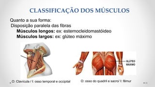 CLASSIFICAÇÃO DOS MÚSCULOS
20
Quanto a sua forma:
Disposição paralela das fibras
Músculos longos: ex: esternocleidomastóideo
Músculos largos: ex: glúteo máximo
O: Clavícula / I: osso temporal e occipital O: osso do quadril e sacro/ I: fêmur
 