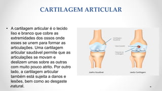 CARTILAGEM ARTICULAR
• A cartilagem articular é o tecido
liso e branco que cobre as
extremidades dos ossos onde
esses se unem para formar as
articulações. Uma cartilagem
articular saudável permite que as
articulações se movam e
deslizem umas sobre as outras
com muito pouco atrito. Por outro
lado, a cartilagem articular
também está sujeita a danos e
lesões, bem como ao desgaste
natural.
 