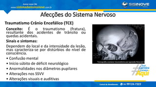 Afecções do Sistema Nervoso
Traumatismo Crânio Encefálico (TCE)
Conceito: É o traumatismo (fratura),
resultante dos acidentes de trânsito ou
quedas acidentais.
Sinais e sintomas:
Dependem do local e da intensidade da lesão,
mas caracteriza-se por distúrbios do nível de
consciência.
• Confusão mental
• Início súbito de déficit neurológico
• Anormalidades nos diâmetros pupilares
• Alterações nos SSVV
• Alterações visuais e auditivas
 
