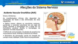 Afecções do Sistema Nervoso
Acidente Vascular Encefálico (AVE)
Sinais e Sintomas:
As manifestações clínicas irão depender da
localização da lesão e das dimensões da área
isquêmica.
• Déficit motor: afetam os neurônios motores,
perdendo o controle voluntário de um lado do
corpo, levando à hemiplegia (se a lesão for no
hemisfério cerebral direito, a hemiplegia irá
aparecer no lado esquerdo).
• Déficit de comunicação: resultado da paralisia da
musculatura vocal, levando a disartria ou afasia.
• Distúrbios da percepção: perda da metade do
campo visual, diplopia, visão noturna prejudicada.
 