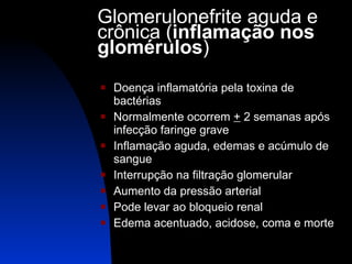 Glomerulonefrite aguda e crônica ( inflamação nos glomérulos ) Doença inflamatória pela toxina de bactérias Normalmente ocorrem  +  2 semanas após infecção faringe grave Inflamação aguda, edemas e acúmulo de sangue Interrupção na filtração glomerular Aumento da pressão arterial Pode levar ao bloqueio renal Edema acentuado, acidose, coma e morte 