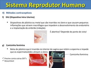 4) Métodos contraceptivos
f) DIU (Dispositivo Intra Uterino)
 Dispositivos de plástico ou metal que são inseridos no útero e que causam pequenas
inflamações que atraem macrófagos que impedem o desenvolvimento do endomério
e a implantação do embrião (nidação).
g) Camisinha feminina
 Bolsa de plástico que é inserida no interior da vagina que retém o esperma e impede
que os espermatozóides atinjam o útero.
Sistema Reprodutor HumanoSistema Reprodutor Humano
Camisinha feminina
 Previne contra várias DST’s
 Descartável
É abortivo? Depende do ponto de vista!
 