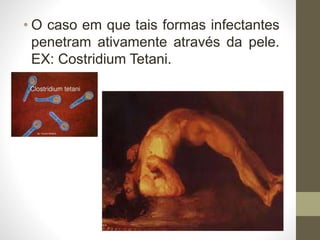 • O caso em que tais formas infectantes
penetram ativamente através da pele.
EX: Costridium Tetani.
 