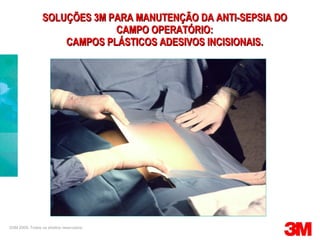 SOLUÇÕES 3M PARA MANUTENÇÃO DA ANTI-SEPSIA DO CAMPO OPERATÓRIO: CAMPOS PLÁSTICOS ADESIVOS INCISIONAIS. ©3M 2009. Todos os direitos reservados. 