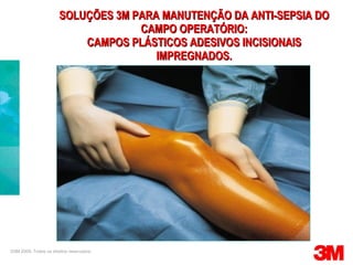 SOLUÇÕES 3M PARA MANUTENÇÃO DA ANTI-SEPSIA DO CAMPO OPERATÓRIO: CAMPOS PLÁSTICOS ADESIVOS INCISIONAIS IMPREGNADOS. ©3M 2009. Todos os direitos reservados. 