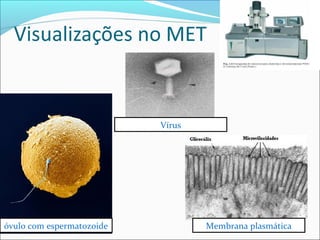 óvulo com espermatozoide
Vírus
Membrana plasmática
 