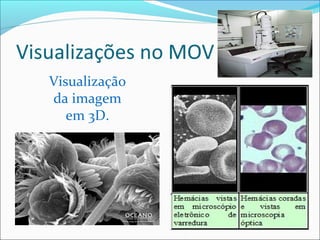 Visualização
da imagem
em 3D.
 
