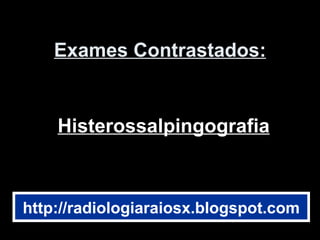 Exames Contrastados: Histerossalpingografia http://radiologiaraiosx.blogspot.com 