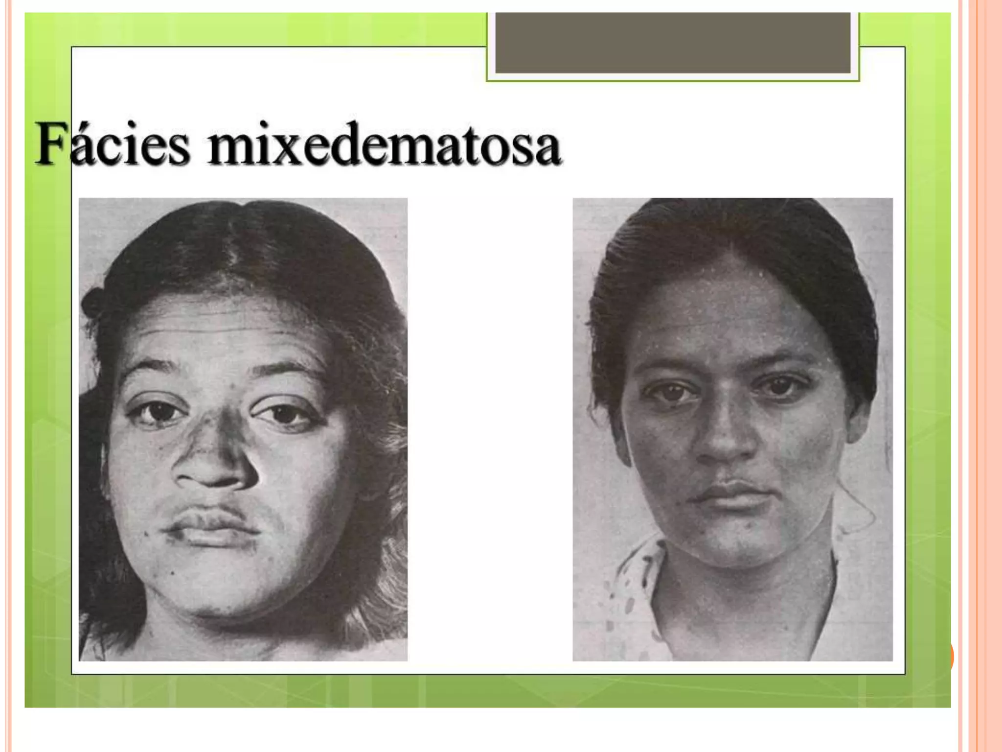 aula-sobre-os-tipos-de-f-ceis-ppt