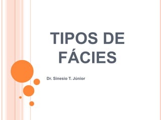 TIPOS DE
FÁCIES
Dr. Sinesio T. Júnior
 