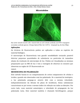 AULAS PRÁTICAS BIOLOGIA FACULDADE DE CIÊNCIAS DA SAÚDE                                        19
Professores: Dr. NewtonSoares da Silva e Dra. Cristina Pacheco-Soares

                                         Microtubúlos




Rat aortic smooth muscle cells stained with an anti-tubulin antibody and FITC-conjugated
secondary antibody (green). (Omega Optical Filter Set # XF71). hotograph by Jim San Fillipo
Aplicações
As técnicas de fluorescência podem ser aplicadas a todas as espécies de
material biológico.
O microscópio de fluorescência tem grande sensibilidade tornando possível
detectar pequenas quantidades de substância ou partículas de tamanhos
abaixo da resolução do microscópio de luz. Podem ser visualizadas as mesmas
preparações que no MO de luz e tem a vantagem de observar os corantes que
absorvem na região do UV fluorescendo no
visível.
MICROSCOPIA DE POLARIZAÇÃO
Este método baseia-se no comportamento de certos componentes de células e
tecidos, quando são observados com luz polarizada. Se o material for isotrópico,
a   luz    polarizada      propaga-se       através     dele    com     a   mesma   velocidade,
independentemente da direção do plano de incidência. Estas substâncias
caracterizam-se por terem o mesmo índice de refração em todas as direções. Por
outro lado, num material anisotrópico a velocidade de propagação da luz
polarizada varia. Este material também é chamado birrefringente, porque
 