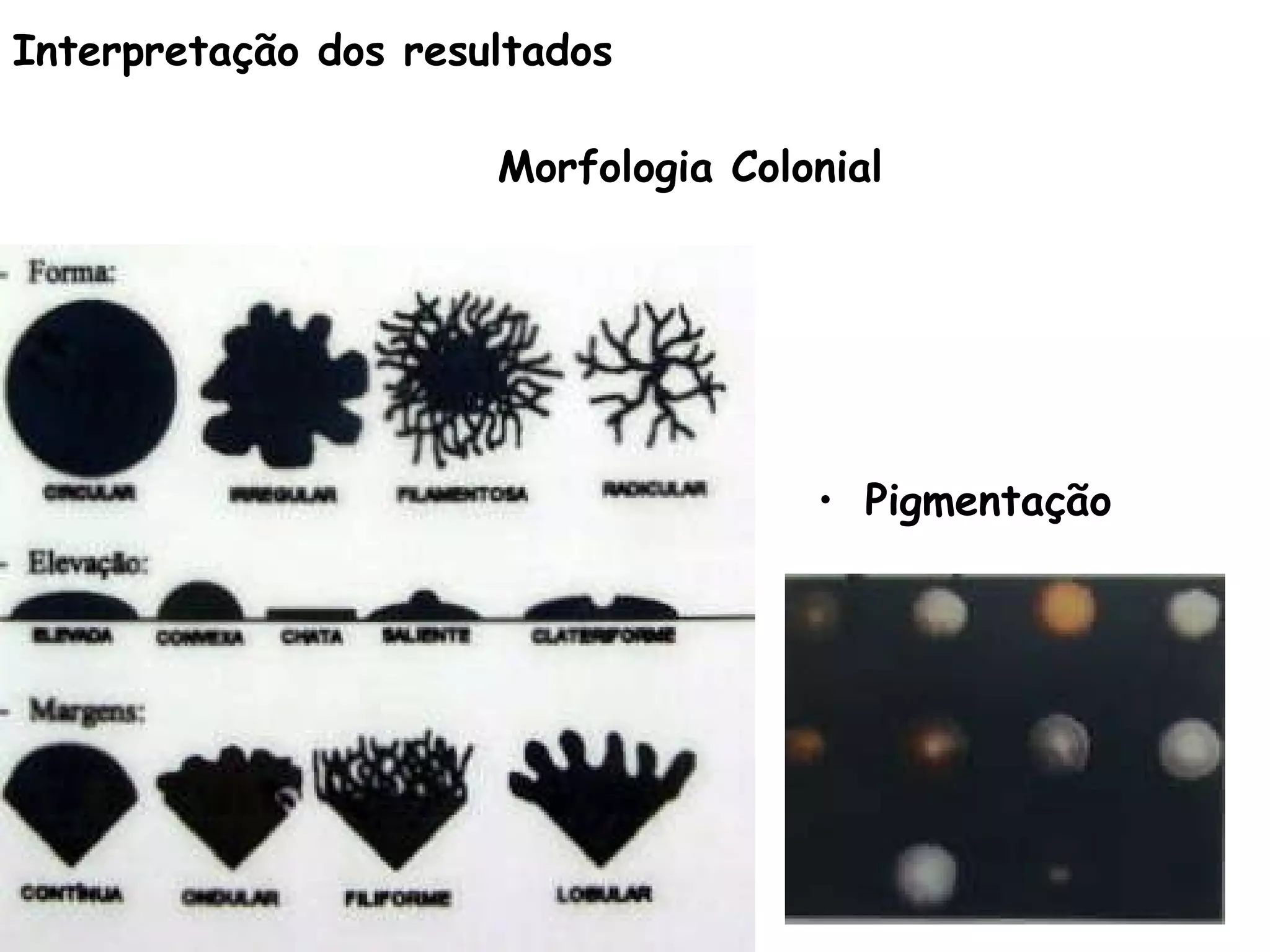 Morfologia Colonial Pigmentação Interpretação dos resultados 