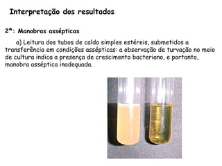 Interpretação dos resultados
2ª: Manobras assépticas
a) Leitura dos tubos de caldo simples estéreis, submetidos a
transferência em condições assépticas: a observação de turvação no meio
de cultura indica a presença de crescimento bacteriano, e portanto,
manobra asséptica inadequada.
 
