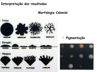 Morfologia Colonial
• Pigmentação
Interpretação dos resultados
 