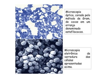 Microscopia
óptica, corada pelo
método de Gram,
de cocos em um
arranjo
denominado
estafilococos.
Microscopia
eletrônica de
varredura das
células
apresentadas
acima.
 