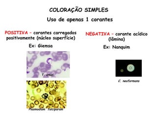 POSITIVA – corantes carregados
positivamente (núcleo superfície)
Ex: Giemsa
NEGATIVA – corante acídico
(lâmina)
Ex: Nanquim
T. cruzi
Plasmodium falciparum
C. neoformans
COLORAÇÃO SIMPLES
Uso de apenas 1 corantes
 