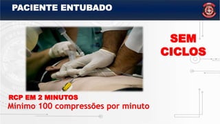 RCP EM 2 MINUTOS
Mínimo 100 compressões por minuto
SEM
CICLOS
PACIENTE ENTUBADO
 