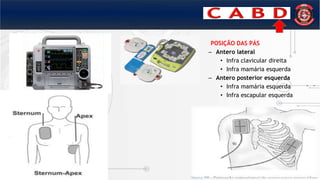 POSIÇÃO DAS PÁS
– Antero lateral
• Infra clavicular direita
• Infra mamária esquerda
– Antero posterior esquerda
• Infra mamária esquerda
• Infra escapular esquerda
 