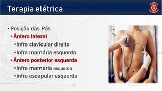 Terapia elétrica
▪ Posição das Pás
▪ Ântero lateral
▪Infra clavicular direita
▪Infra mamária esquerda
▪ Ântero posterior esquerda
▪Infra mamária esquerda
▪Infra escapular esquerda
 